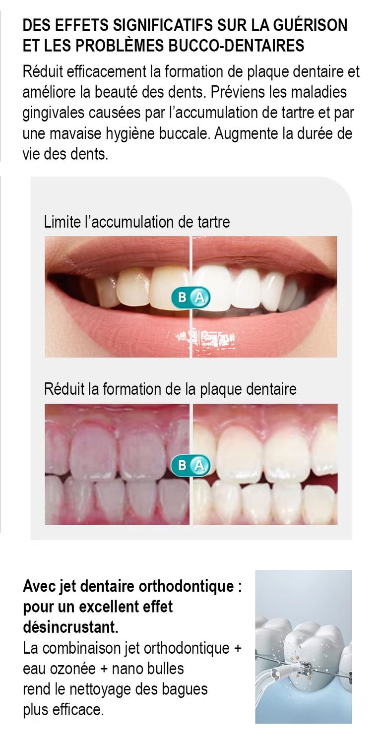 Jet dentaire à eau ozonée - Avec 3 jets dentaires professionnels : jet standard, orthodontique et pointe fine - Concentration en ozone élevée de 0.5 à 2.6mg/L (PPM) - France UVC
